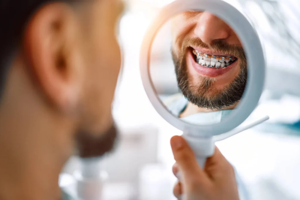reliable Invisalign and braces Da Vista St. Pete