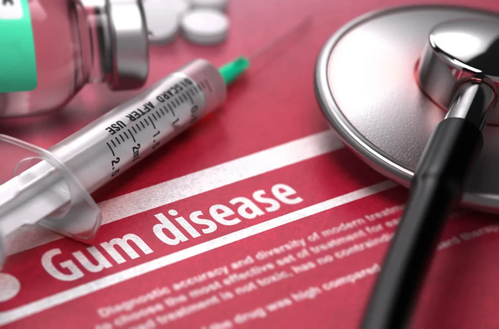 Gum disease treatment in Imperial Courts Clearwater form