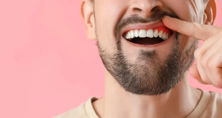needs Gum disease treatment in Imperial Courts Clearwater