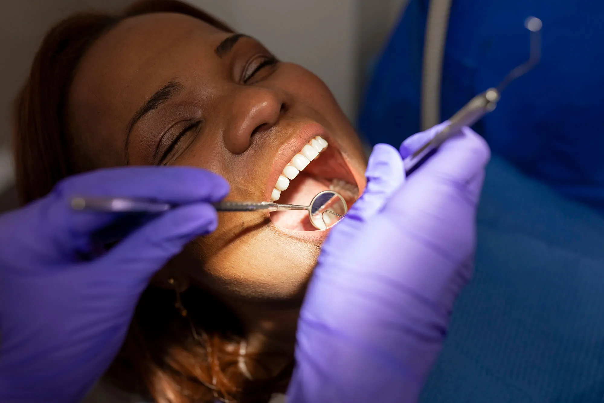 ongoing Professional teeth cleaning Da Vista St. Pete