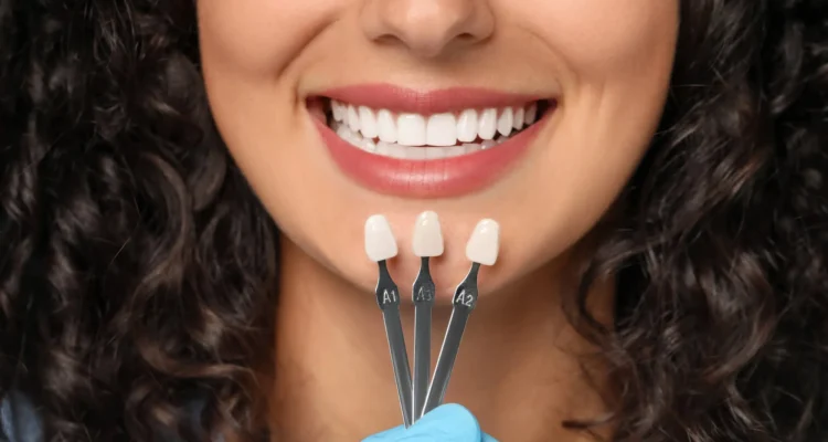 cosmetic dentistry clearwater fl