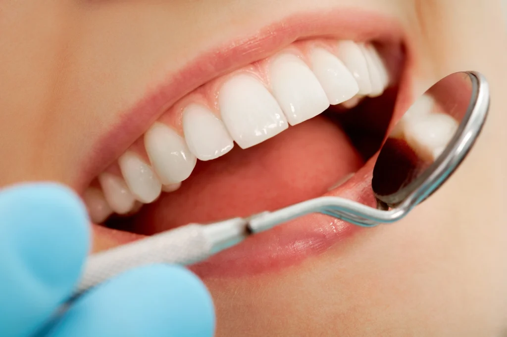 bright smile after going to teeth whitening specialists in Grovewood, FL