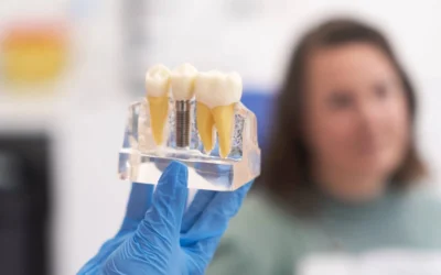 dentist explaining dental implants in Clearwater FL