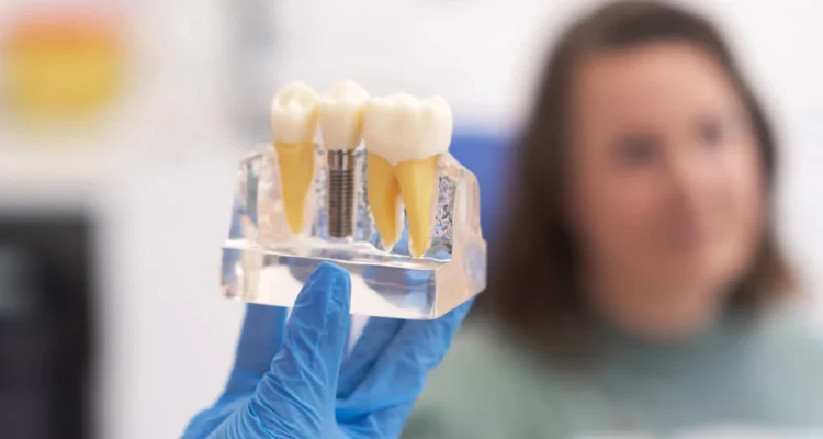 dentist explaining dental implants in Clearwater FL