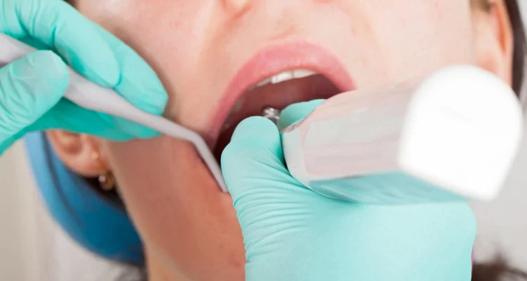 St. Petersburg emergency dental services in Da Vista
